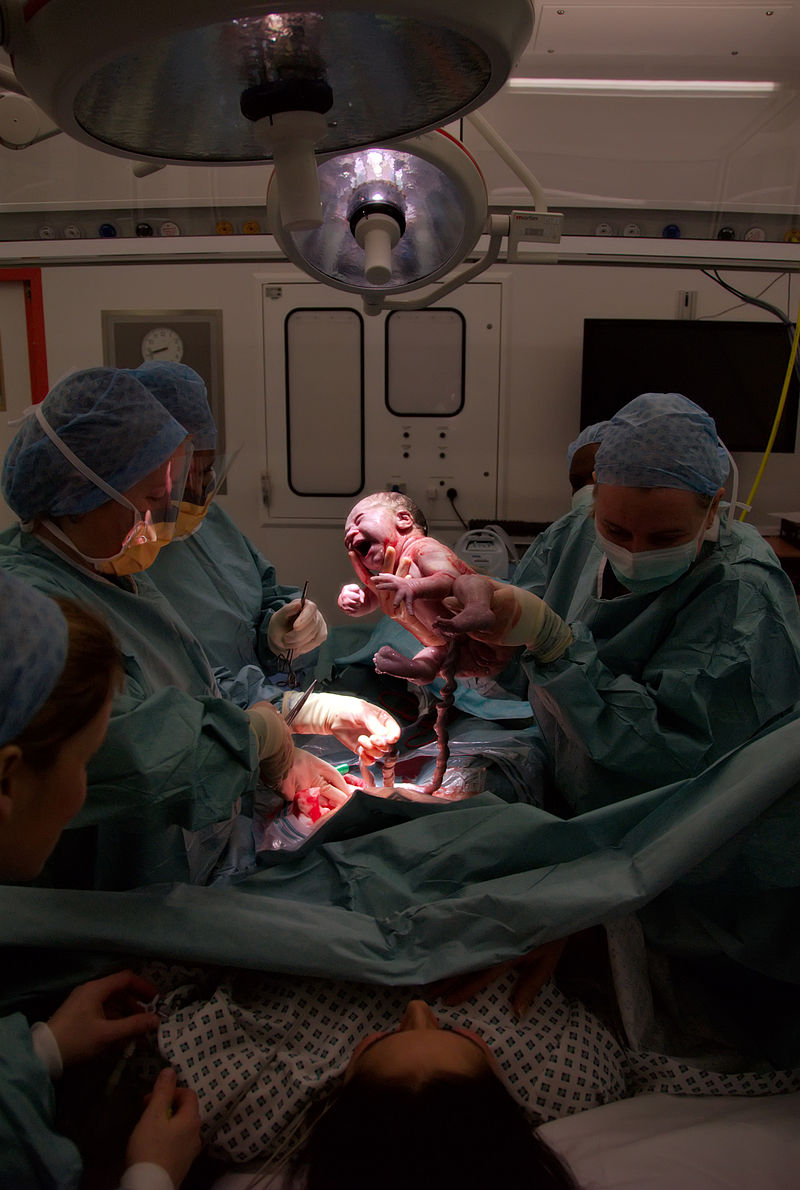 Caesarean Salim Fadhley via Wikipedia Commons