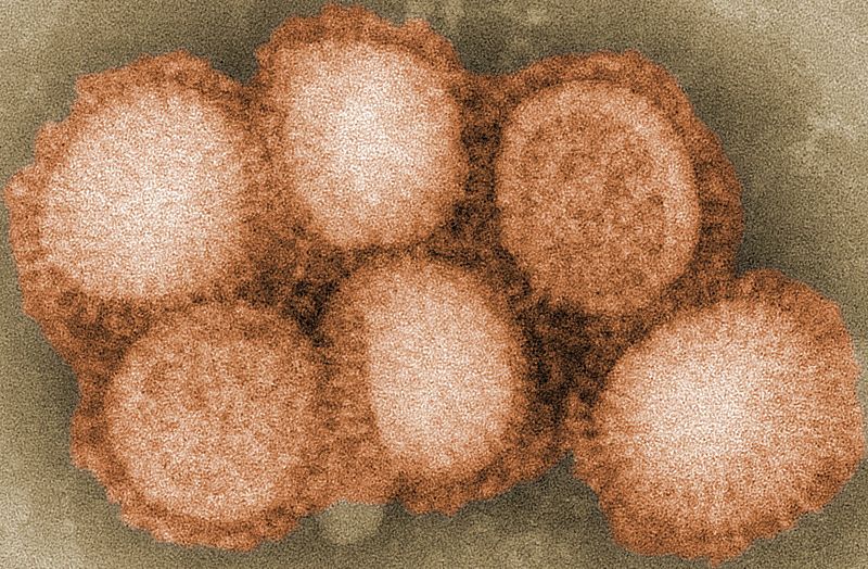 Flu virus via Wikipedia Commons