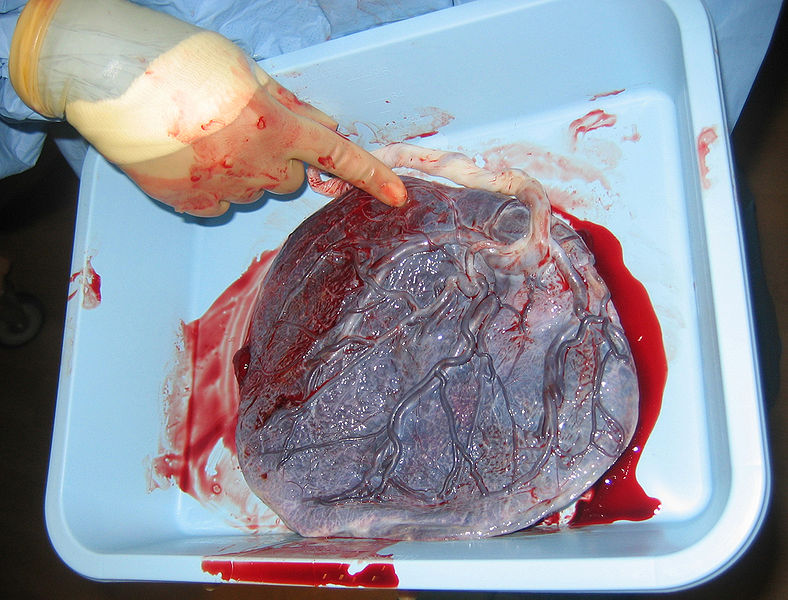 Placenta Wikipedia Commons