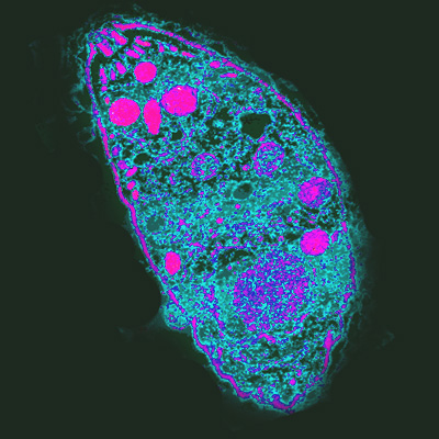 By AJ Cann from UK (Toxoplasma gondii) [CC BY-SA 2.0 (http://creativecommons.org/licenses/by-sa/2.0)], via Wikimedia Commons